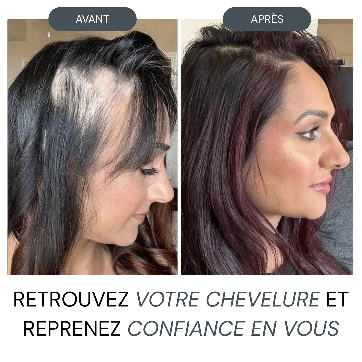 Cure Anti-Chute Nouvelle Génération